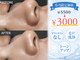 オンフリーク(ON FLEEK)の写真