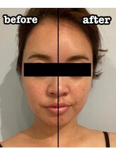 ルナグランデ(Luna grande.)/効果写真