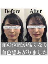 ハリサロンドオフ 心斎橋店(hari salon de off)/頬の位置に注目