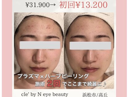 クレバイエヌアイビュティー(cle' by N eye beauty)の写真