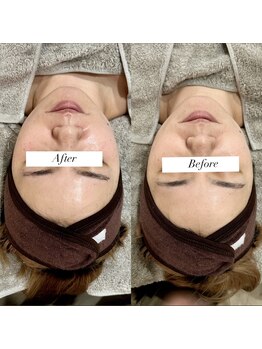 ラ フルール(La Fleur)/カーボキシートリートメント