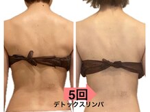 シャイン(shine)/デトックスリンパ120分　5回