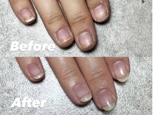 結(Yui)/自爪育成 Before→After