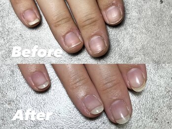 結(Yui)/自爪育成 Before→After