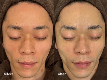 アウラ 小杉店(AULA)/ララピール☆