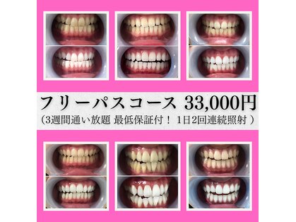 ルブラン 奈良店(Le Blanc)の写真