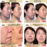 経堂鍼灸整体院