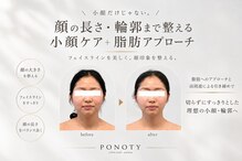 ポノティー(PONOTY)