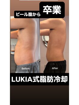 ルキア(LUKIA)の写真/男の本気痩せ！脂肪冷却でお腹の脂肪を狙い撃ち＆引き締めボディに！脂肪冷却でぽっこりお腹を撃退！