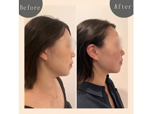 ルサンク(le cinq)の雰囲気（低周波を流しながら手でマッサージ◎ 一度で変化感じられます！）