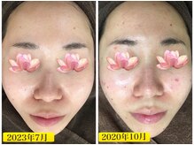 ビエル(Bielle)/鏡をみるのが嫌だった