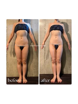 ボーレーヴ 表参道店(beaureve)/施術効果写真(before after)