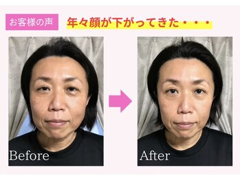 アイキ(aiki)/年々顔が下がってきた、、