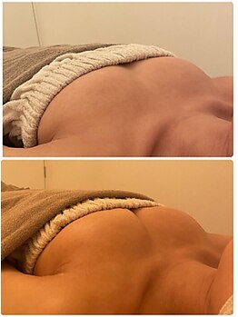 美人バスト 千葉店/バストケア