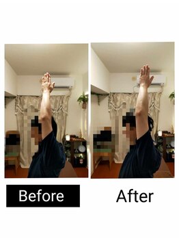 アース エンジェル整体院/ビフォアフ 肩こり ストレッチ