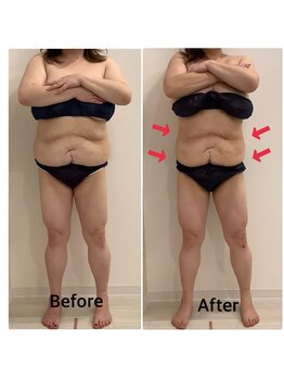 スペチアーレ 夙川/湘南や品川でも人気の脂肪冷却