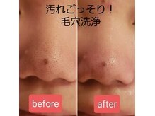 脱毛エステティックサロン ビビ(vivi)