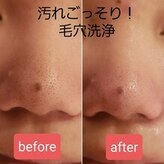 脱毛エステティックサロン ビビ(vivi)