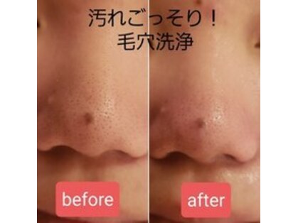 脱毛エステティックサロン ビビ(vivi)の写真