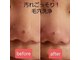 脱毛エステティックサロン ビビ(vivi)の写真