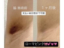 オリ('OLI)