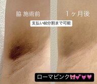 オリ('OLI)
