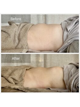 メゾンドメリッサ(MAISON de MELISSA)/