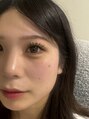 アンジープラス(ANZY+)&nbsp;カワイイ♪【真ん中長め】デザイン
