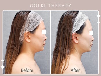 シロカネ 光の森店(SHIROKANE)/韓国式小顔コルギ☆