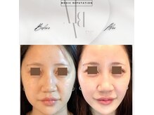 ミエリア美容鍼灸院(mielia美容鍼灸院)の雰囲気（身体の鍼灸を組み合わせることも◎首コリはほうれい線にも効果的）