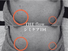 ザ フロウ(THE flow)/シミケア１回｜before/after