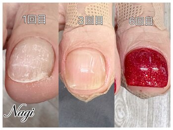 ナギネイル(Nagi Nail)の写真/【日常に溶け込む”大人の身だしなみ”】トータルケアで美しいお手元＆お足元に♪[ハンドケア/フットケア]