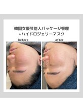 ポムハヌル(pom.haneul)/韓国肌管理室