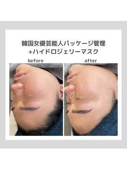 ポムハヌル(pom.haneul)/韓国肌管理室