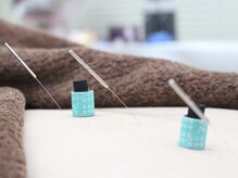 ビビオンリーワン 銀座築地(vivi only one)/全身鍼灸コース