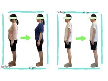 ラーナビコツ(RANA-bikotsu)/ＢＥＦＯＲＥ－ＡＦＴＥＲ