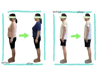 ラーナビコツ(RANA-bikotsu)/BEFORE-AFTER