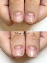 マリーロール 淀屋橋本店(Marie Laure)/自爪育成/深爪矯正/ネイルケア