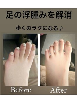 禅(ZEN)/妊婦様フットケア