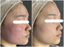 レーヴ アヴニール(Reve Avenir)/しっかりカウンセリング