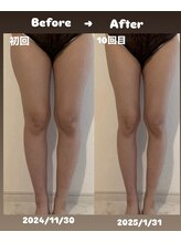 ベル/フォースカッター半身インディバ