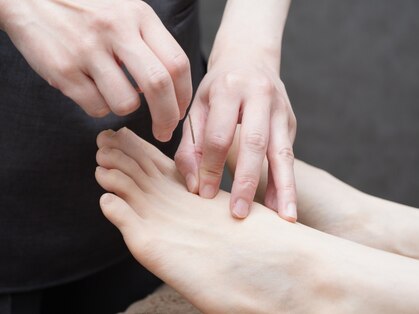 ユメ(YUME)の写真