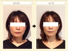 美容整体ウェリナ あま甚目寺院/小顔矯正/骨盤矯正/美脚サロン