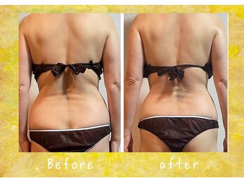 マタハリ(Matahari)/4D筋膜リリース