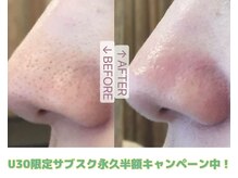 シロ(CHILO)の雰囲気（U30限定！人気のサブスクプランが永久半額♪）