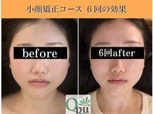 キュープ 表参道店(Qpu)/続けた方しか感じられない変化♪