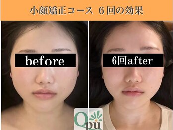 キュープ 表参道店(Qpu)/続けた方しか感じられない変化♪