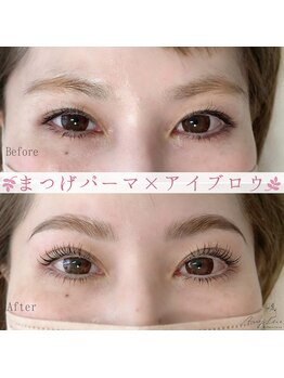 アマリリス(Amaryllis)/ハリウッドブロウリフト(HBL)