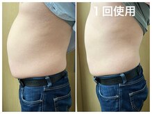 マイティー整骨院 ココア(CoCoa)/メンズも大歓迎♪痩身マシン