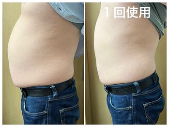 マイティー整骨院 ココア(CoCoa)/メンズも大歓迎♪痩身マシン